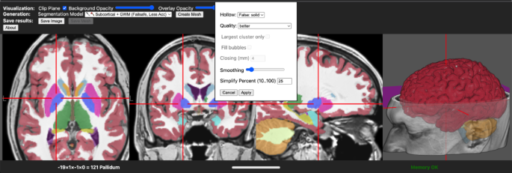 brain2print AI powered web tool for creating 3D printable brain models