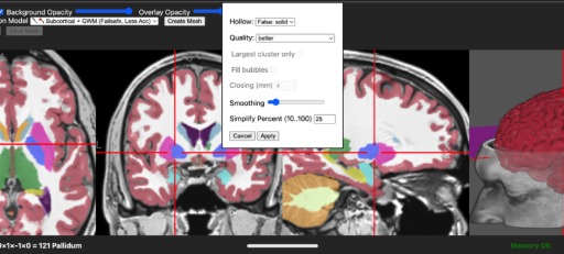 brain2print AI powered web tool for creating 3D printable brain models