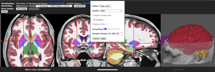 brain2print AI powered web tool for creating 3D printable brain models