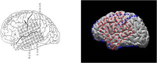 N-Tools-Browser: Web-Based Visualization of Electrocorticography Data for Epilepsy Surgery