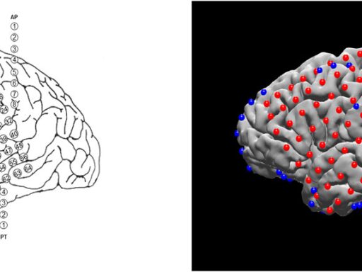 N-Tools-Browser: Web-Based Visualization of Electrocorticography Data for Epilepsy Surgery